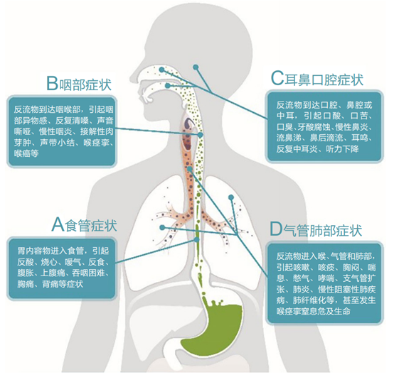 一文读懂胃食管反流病的诊断和治疗