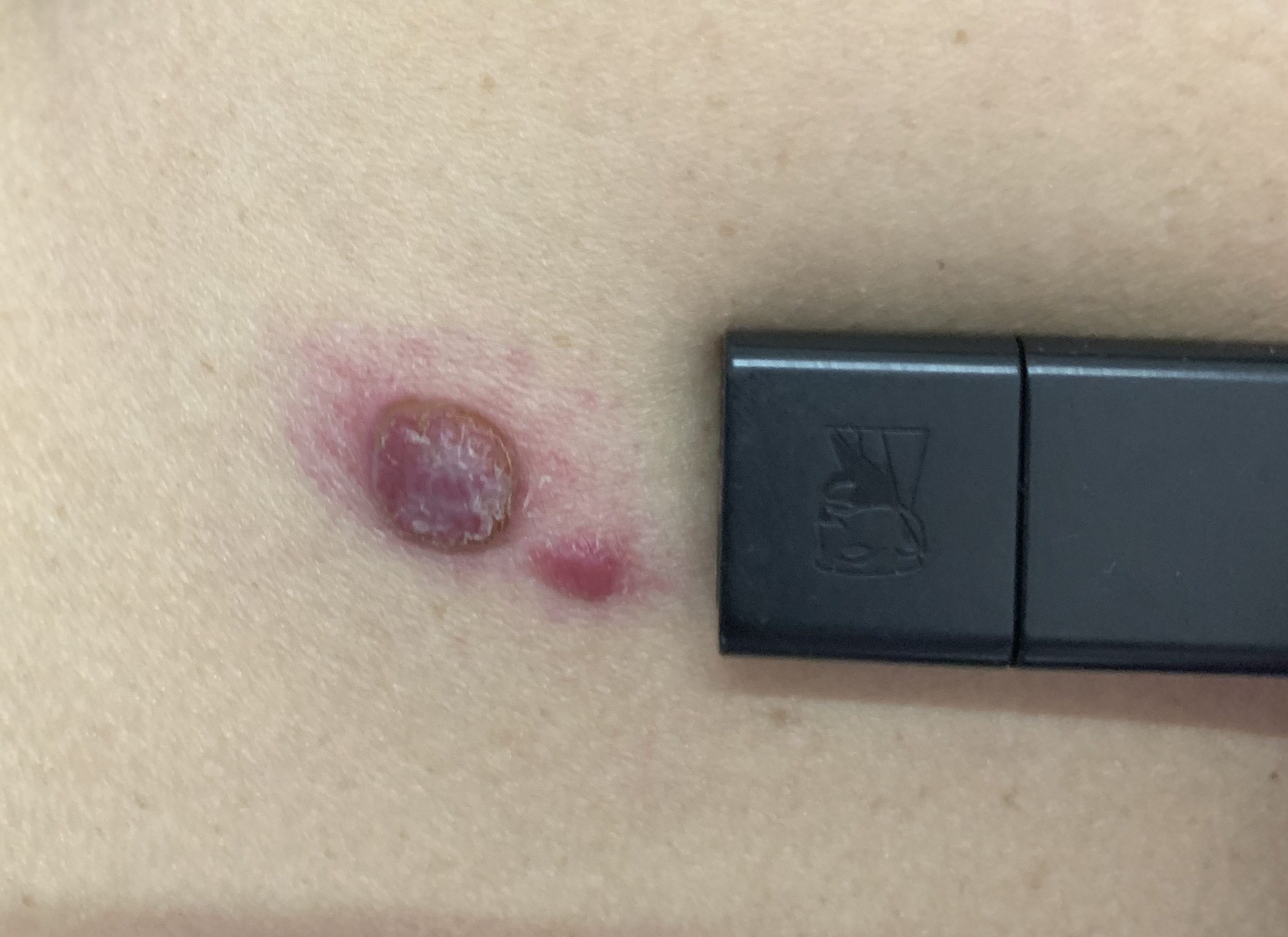 病例分享20210607-老苏