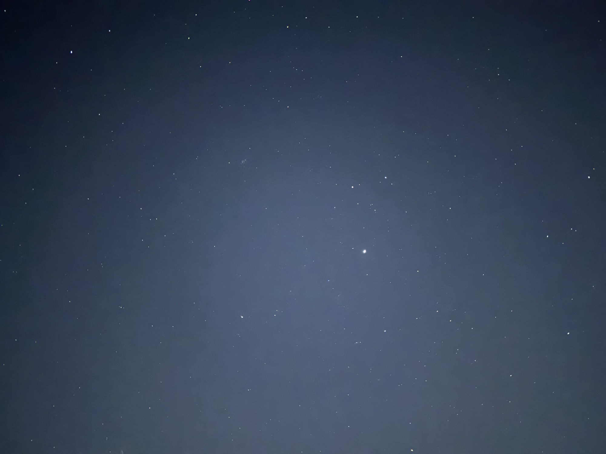 胃电图（EGG）临床操作与分析指南（2026 中华医学会标准）